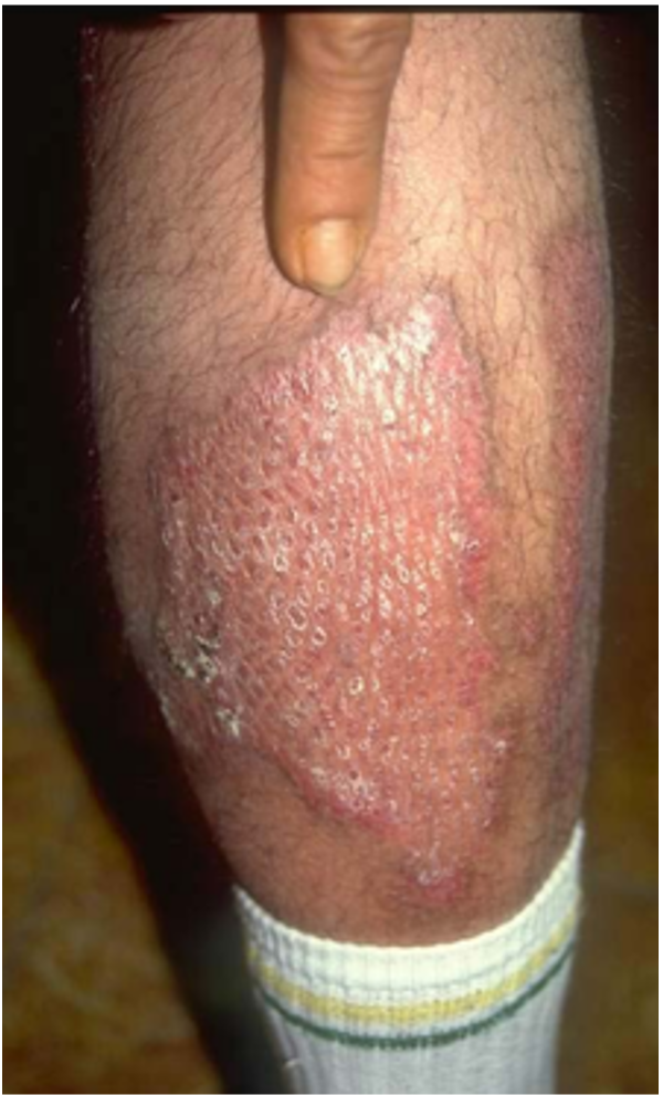 After image